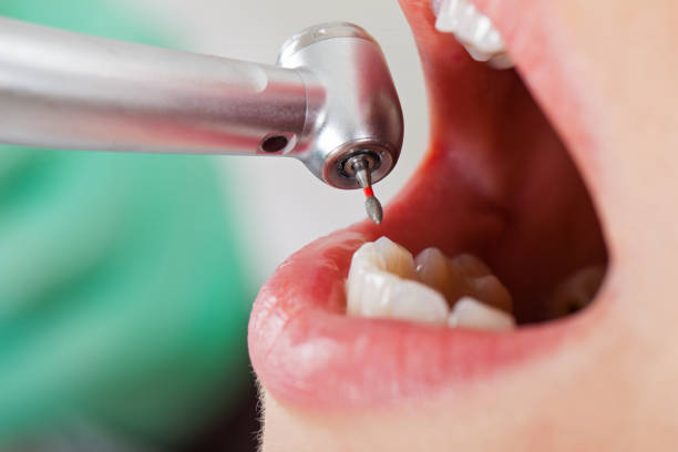 Best Mobile Emergency Dentist in San Benito, TX